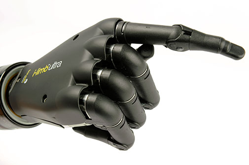 10-year-old second youngest person ever to be fitted with bionic limb