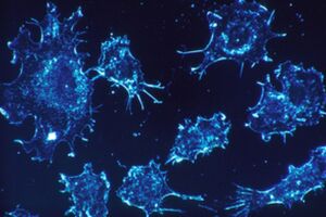 £70m investment in radiotherapy technology to transform cancer care across England