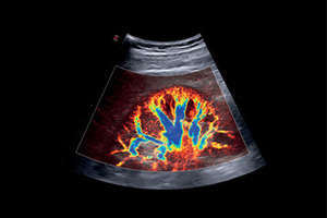 A new era for ultrasound technology emerges in European healthcare