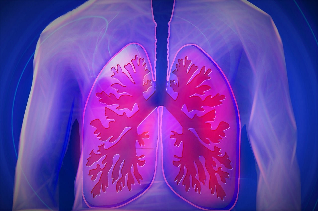 AI lung cancer diagnosis innovator secures $14m funding to accelerate expansion