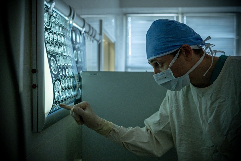 AI to speed up radiotherapy planning