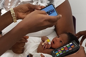 App detecting jaundice may prevent deaths in newborns