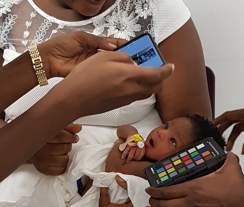 App detecting jaundice may prevent deaths in newborns