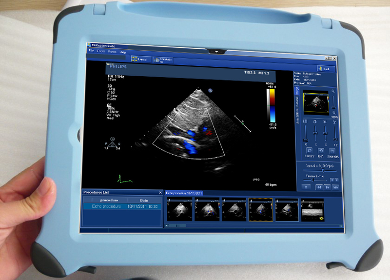 Apple technology boosts care at Great Ormond Street