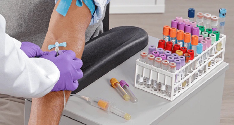 Becton, Dickinson and Company’s BD Vacutainer SST Blood Collection Tubes are among 18 medical devices awarded 'exceptional use authorisation' in an effort to maintain access to vital supplies across the NHS