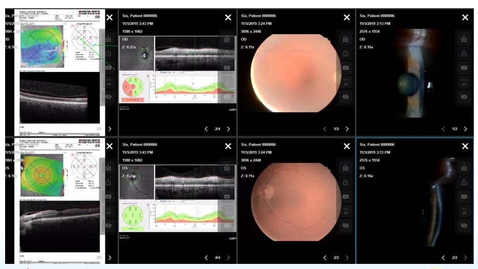 An example of static retinal images uploaded from a community optometrist to the patient OpenEyes record, which won Cardiff and Vale University Health Board three awards, including the Award for Best Use of Technology (Primary/Community Care) for 2021