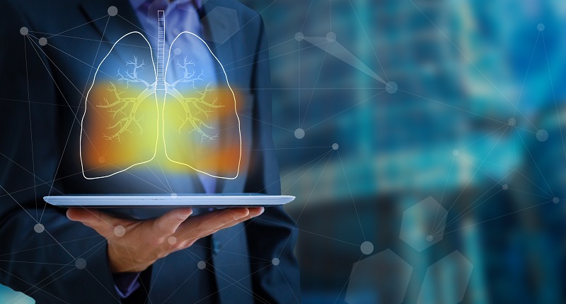 The new research will gauge the impact of AI diagnostics in enabling earlier treatment of lung cancer