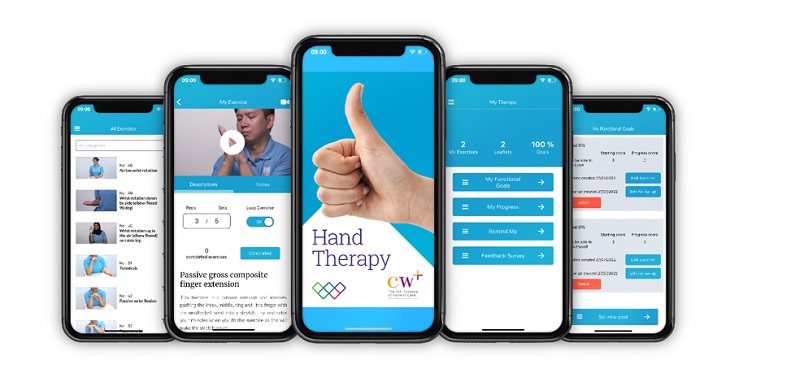 The app was developed in 2017 to support patients recovering from hand and wrist injuries