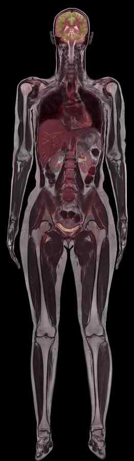 University College London Hospitals orders first Biograph mMR system 