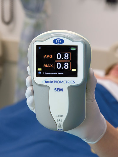 BBI receives Frost & Sullivan Award for New Product Innovation for Pressure Ulcer Diagnostics