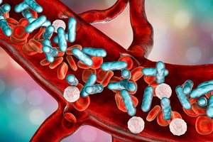 Beckman Coulter partners with South West London Pathology to reduce the impact of sepsis 