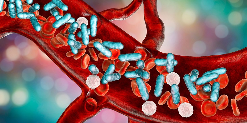 Beckman Coulter partners with South West London Pathology to reduce the impact of sepsis 