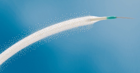 BIOTRONIK announces Europe-wide release of Passeo-18 Lux Peripheral Vascular Drug Releasing Balloon