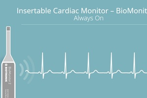 Biotronik study validates in-office insertion of BioMonitor 2 Cardiac Monitor