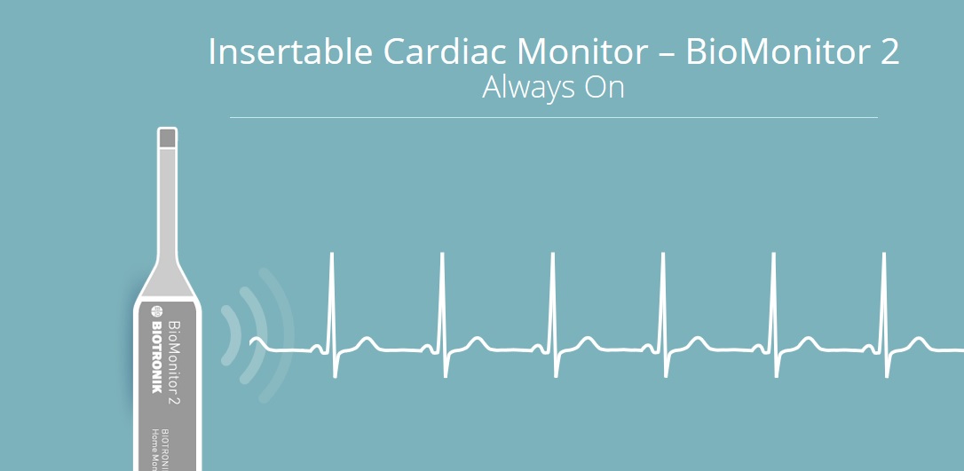 Biotronik study validates in-office insertion of BioMonitor 2 Cardiac Monitor