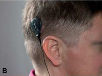 Blind Paralympian able to see again thanks to revolutionary chip
