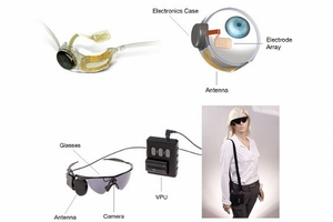 Breakthrough as \'bionic eye\' restores sight for \'majority\' of blind patients
