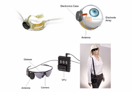 Breakthrough as \'bionic eye\' restores sight for \'majority\' of blind patients