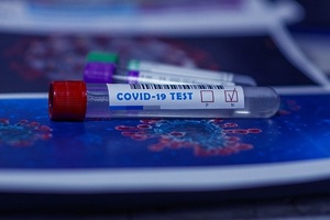 Breakthrough in COVID-19 testing