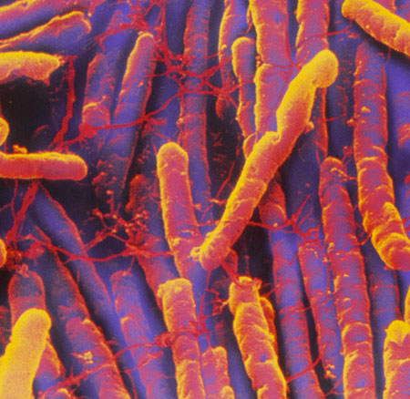 C.difficile patients in Derby to carry warning cards