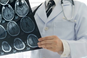 Cancer Research UK launches Brain Tumour Awards