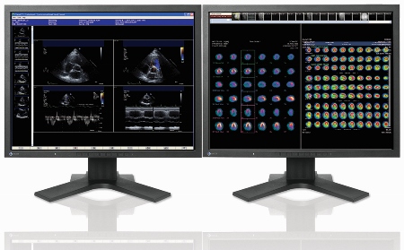 Carestream signs seven-year PACS deal with Homerton University Hospital
