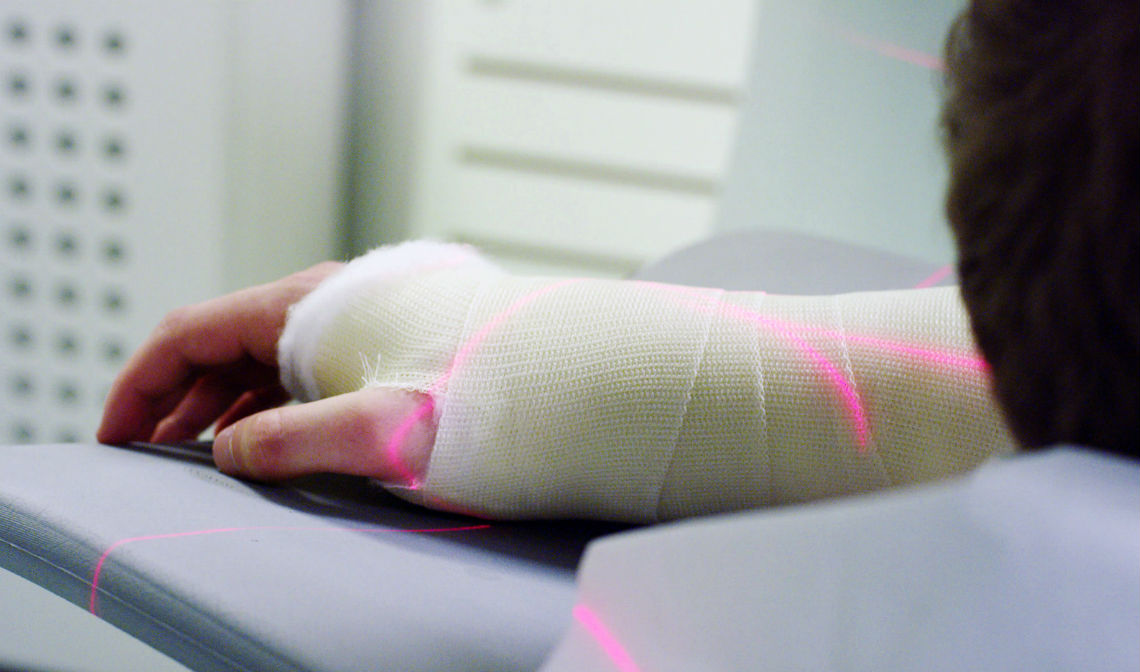 Case study: Instant surgical planning with low-cost 3D printed bone models