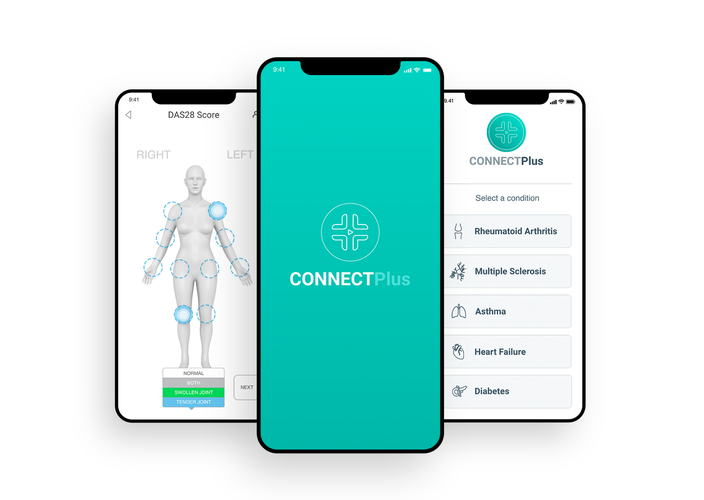 Case study: Multiple conditions app transforms long-term condition management