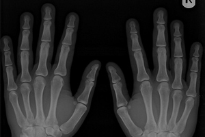 Case study: Saving money on imaging equipment maintenance