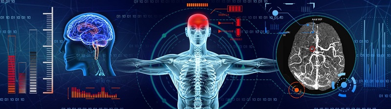 Cheshire and Merseyside clinical network launches pioneering AI stroke project