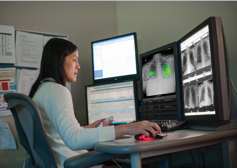 Collaboration uses AI algorithms to help predict COVID-19 severity, complications and long-term impact
