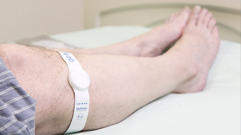 In the study over 90% of patients tolerated the device and there were no incidences of VTE reported 90 days post discharge, compared to 2.4% of patients who received traditional IPC treatment