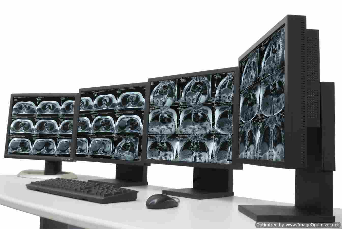 Comment: Unlocking efficiency gains through cross-site reporting of diagnostic imaging