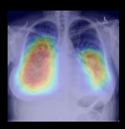 Dartford and Gravesham NHS Trust implements AI in radiology