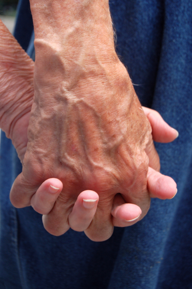 Dementia design under the spotlight