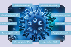 Diagnostic tool for sexually transmitted infections received CE Mark