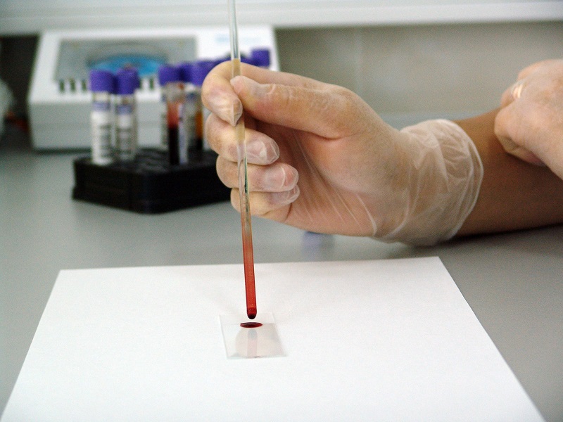 Digital breakthrough will revolutionise clinical trial management