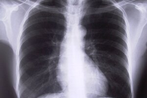 Eighth hospital trust joins radiology consortium