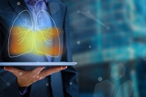 First-of-a-kind AI project detects early-stage lung cancer
