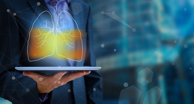 First-of-a-kind AI project detects early-stage lung cancer