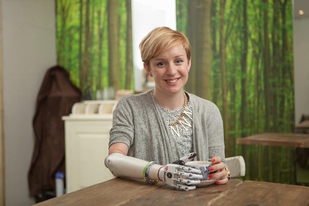 First UK user receives world’s most-lifelike bionic hand