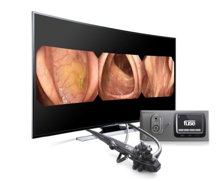Fuse second-generation Full Spectrum Endoscopy System released by EndoChoice 
