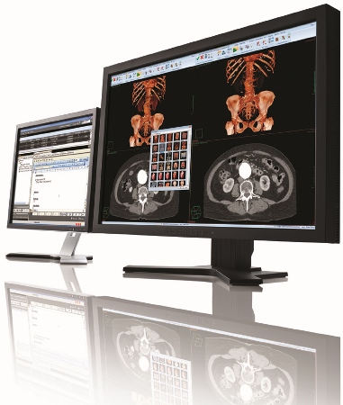 Gateshead trust to deploy PACS and RIS systems