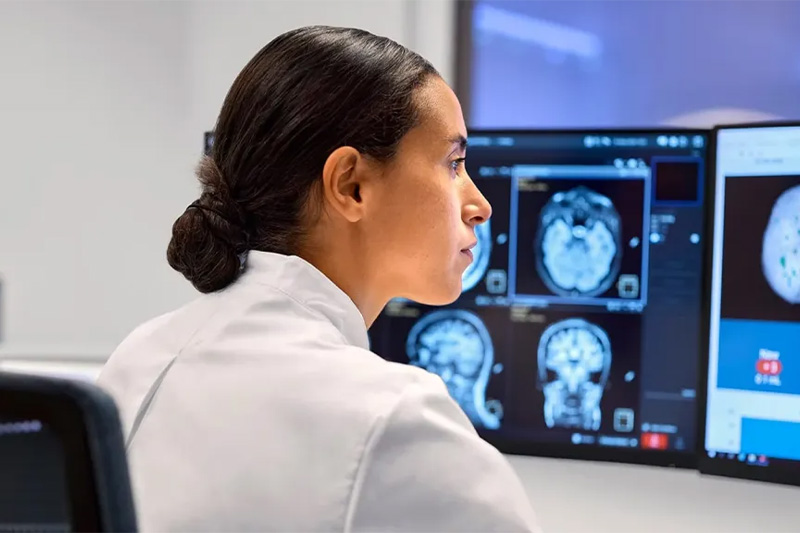 GE HealthCare announces intent to acquire icometrix to strengthen neurology portfolio with brain MRI assessment solutions