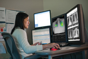 GE Healthcare launches new AI suite to detect chest X-ray abnormalities