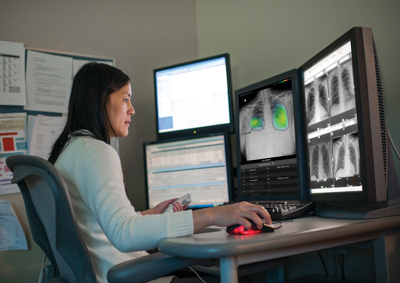 GE Healthcare launches new AI suite to detect chest X-ray abnormalities