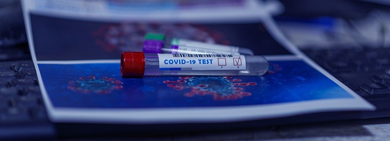 Government announces partnership with rapid test manufacturers