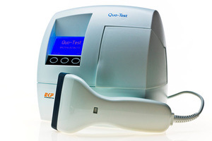 HbA1c testing recommended for early detection of type 2 diabetes