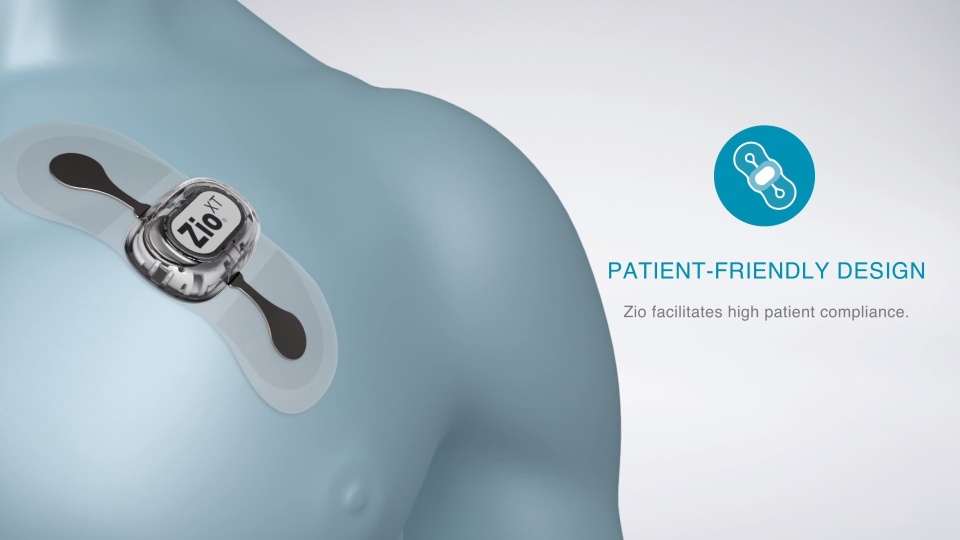 irhythm's Justin Hall welcomed the investment, which will see increased use of innovations such as its cardiac monitoring device