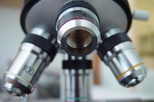 Home urine test for prostate cancer could revolutionise diagnosis
